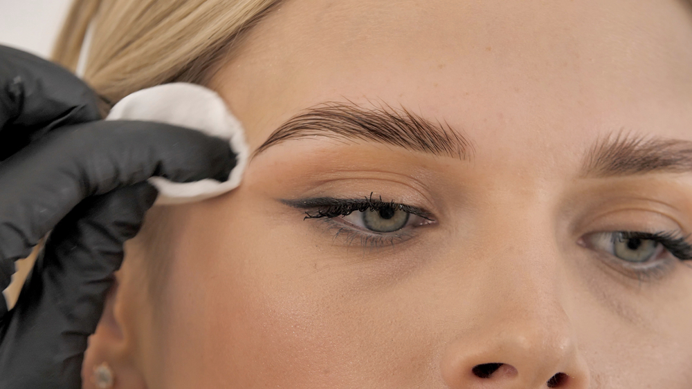 Ultherapy Brows in Costa Mesa